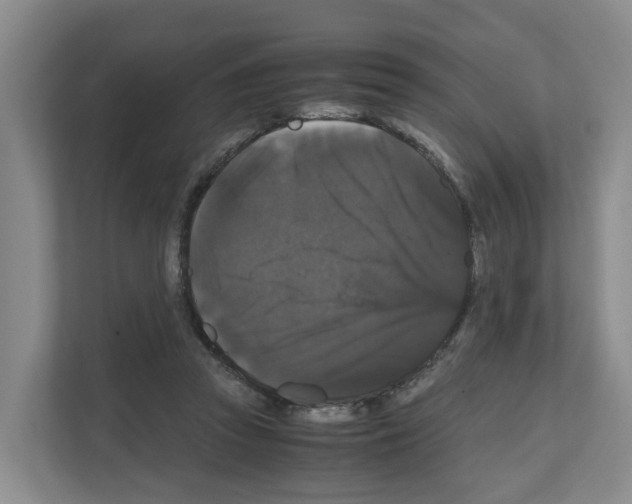 X0000111120353200908111023