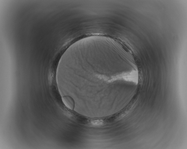 X0000111120355200908111023