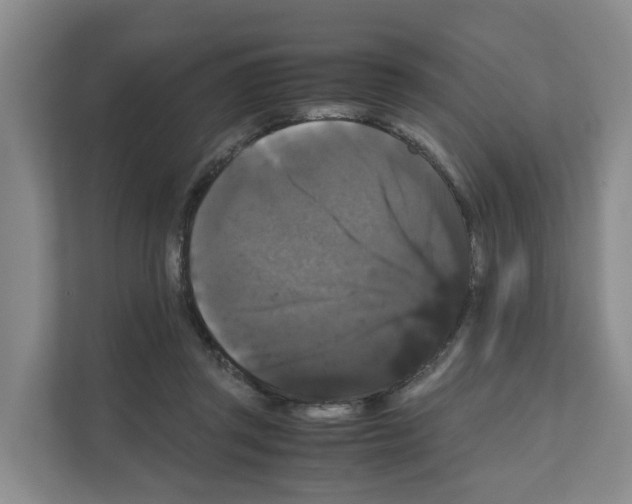 X0000111120357200908111023