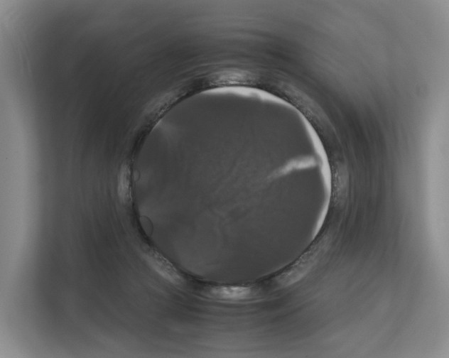 X0000111120361200908111023