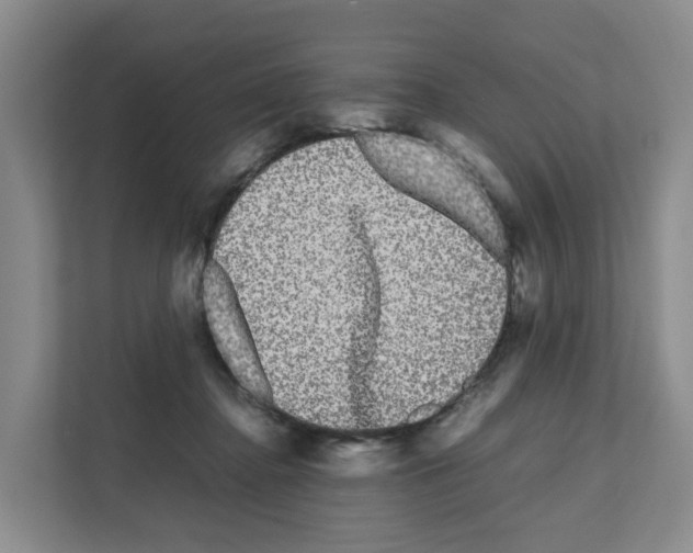X0000111120364200908111023