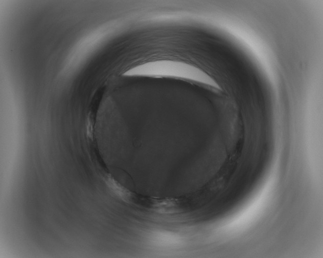 X0000111120382200908111024