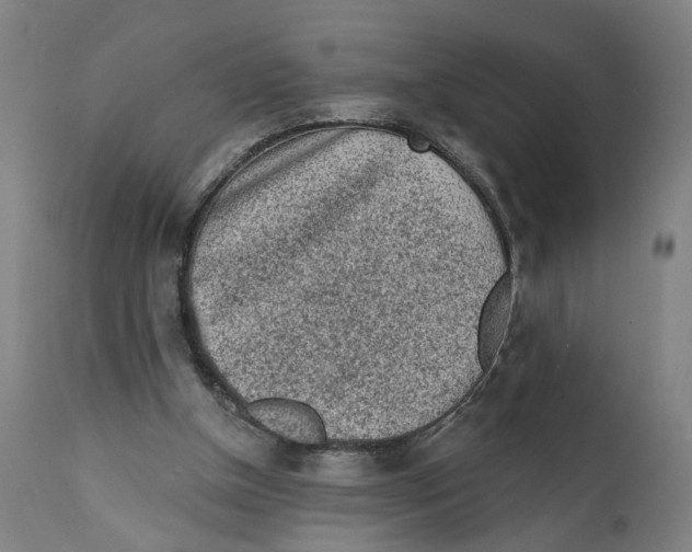 X0000111130154200907211122