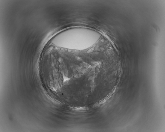 X0000111140151200906301024