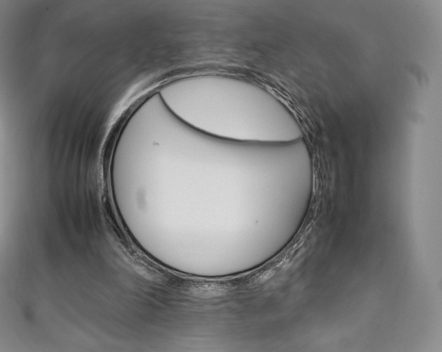X0000111140198200906301024