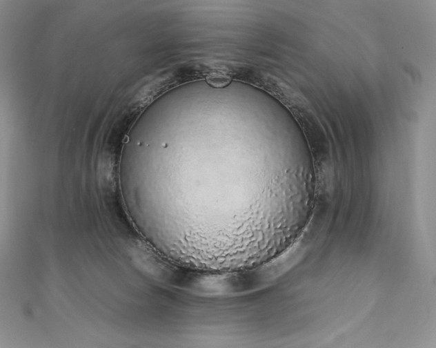 X0000111140178200906301237