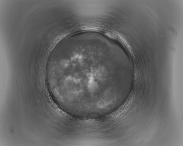 X0000111140385200906301234