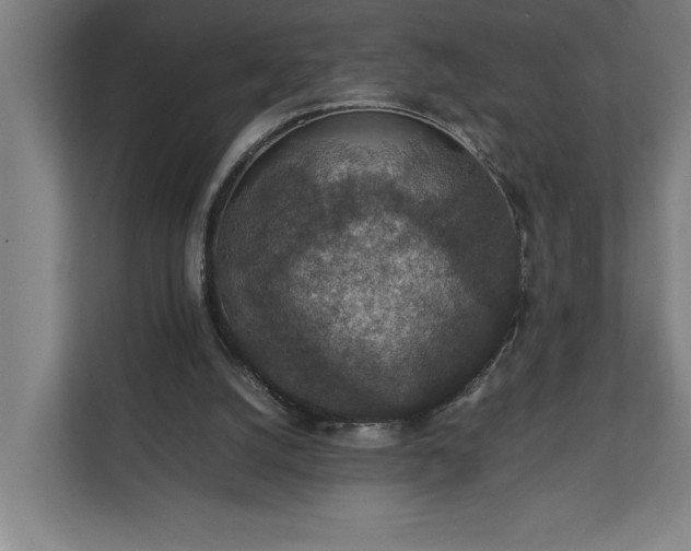 X0000111140056200907071057