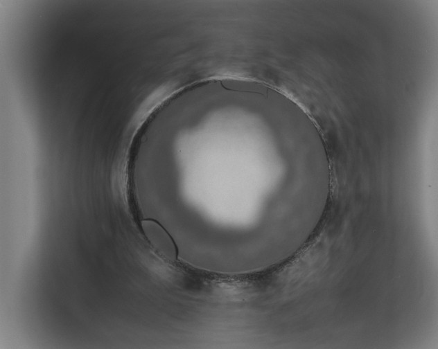 X0000111140199200907071055