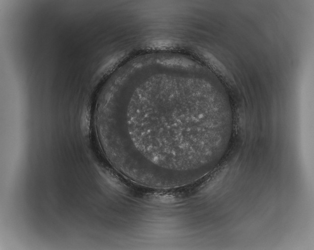 X0000111140640200907071049