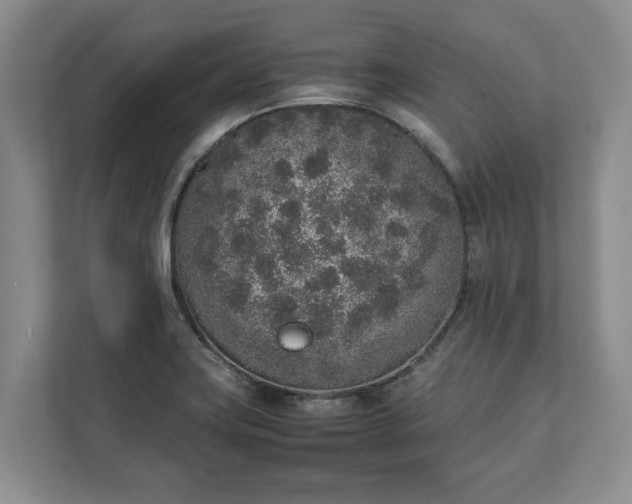 X0000111141419200907071040