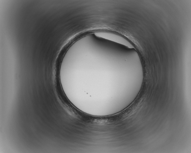 X0000111140440200907141324