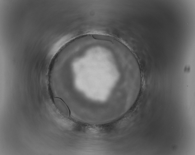 X0000111140199200907211147