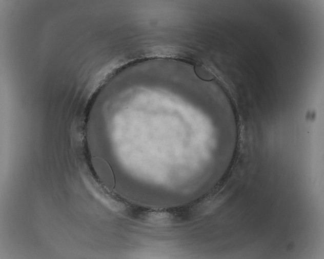 X0000111140203200907211147