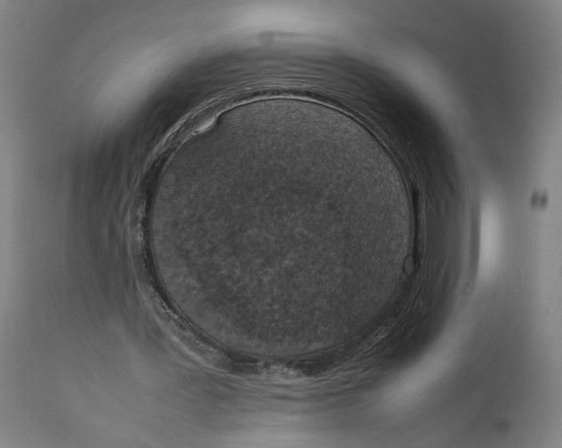 X0000111140387200907211144