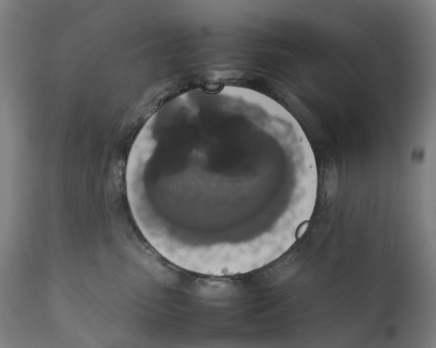 X0000111140475200907211143