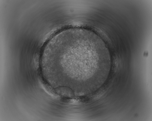 X0000111140496200907211142