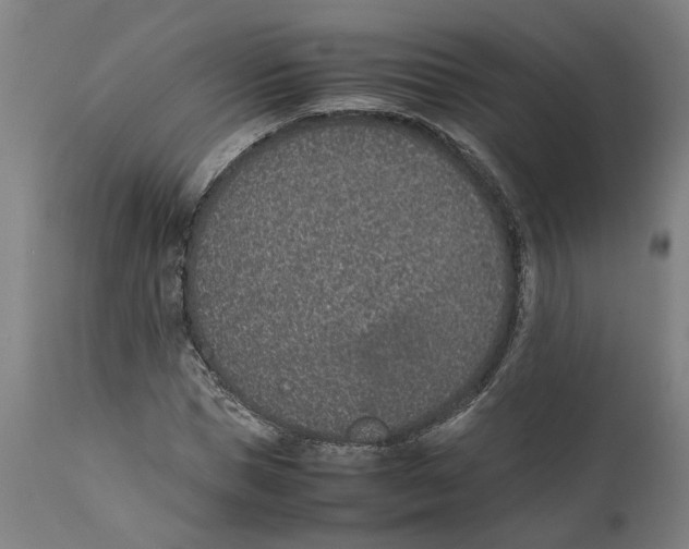 X0000111140921200907211135