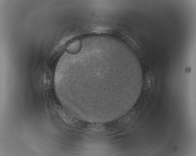 X0000111141158200907211131