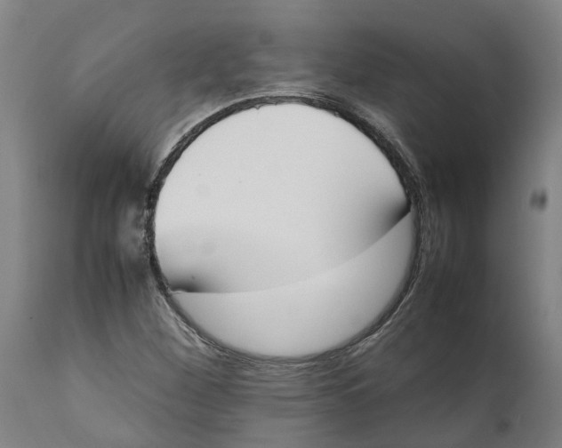 X0000111141260200907211130