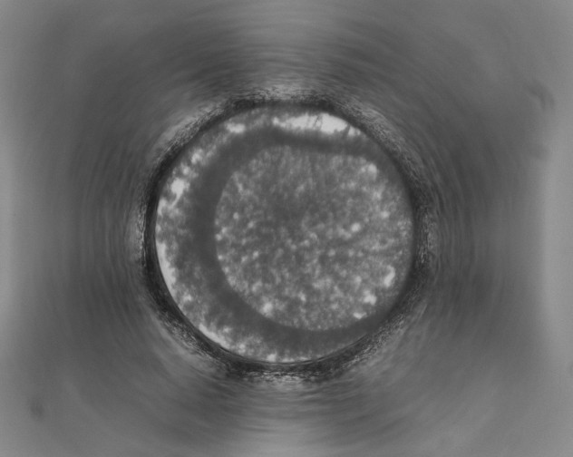 X0000111140640200907281113