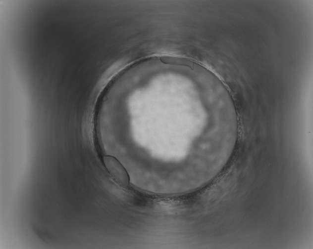 X0000111140199200908111120