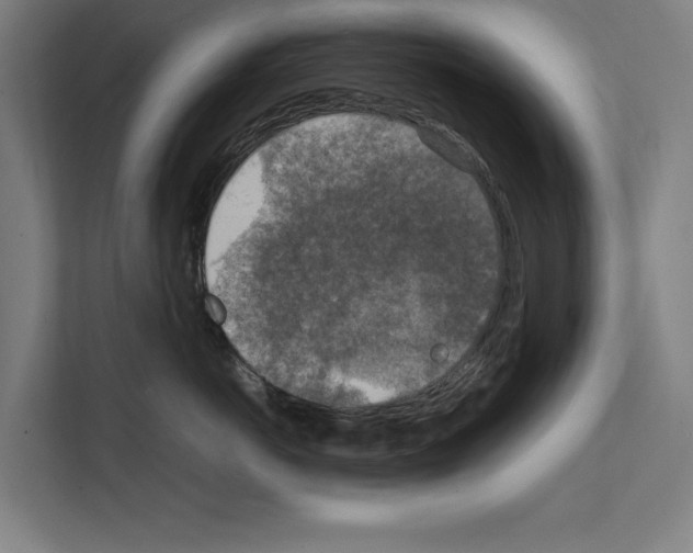 X0000111140766200908111114