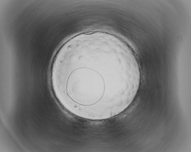 X0000111141525200908111104