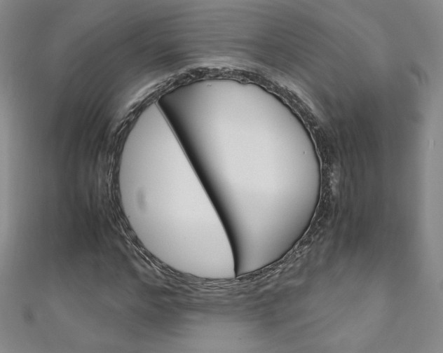 X0000111150968200906301034
