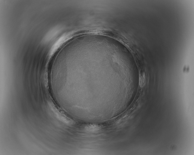 X0000111150198200906301345