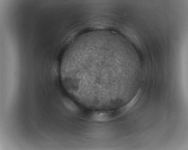 X0000111150174200907071116