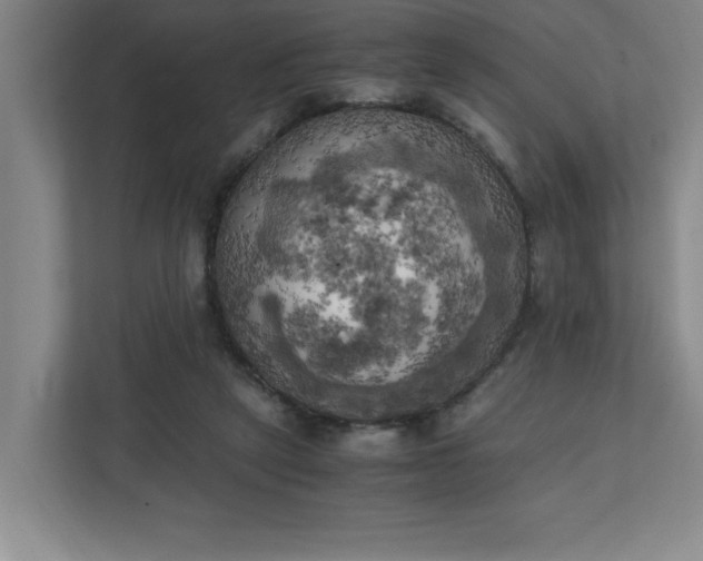 X0000111150257200907071115