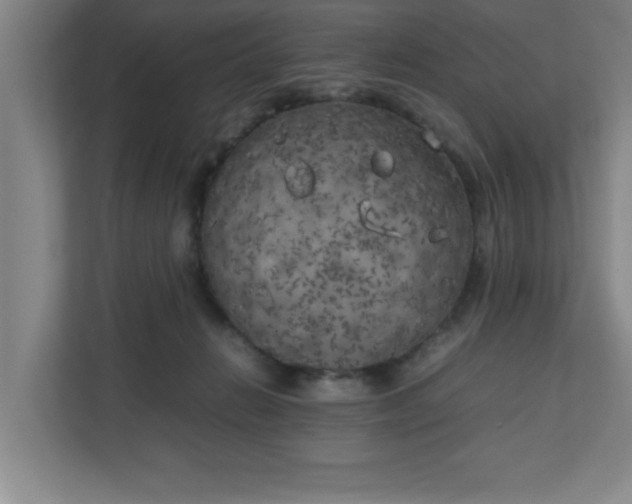 X0000111150270200907071115