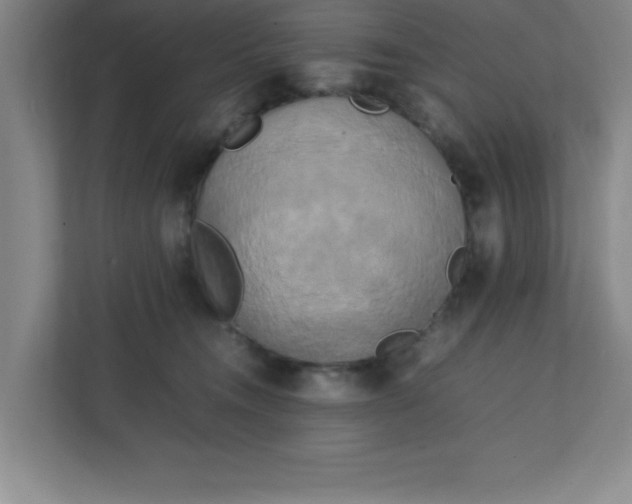 X0000111150372200907071114
