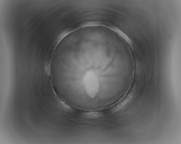 X0000111150953200907071106