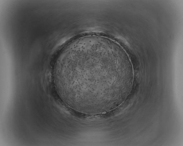 X0000111151159200907071103