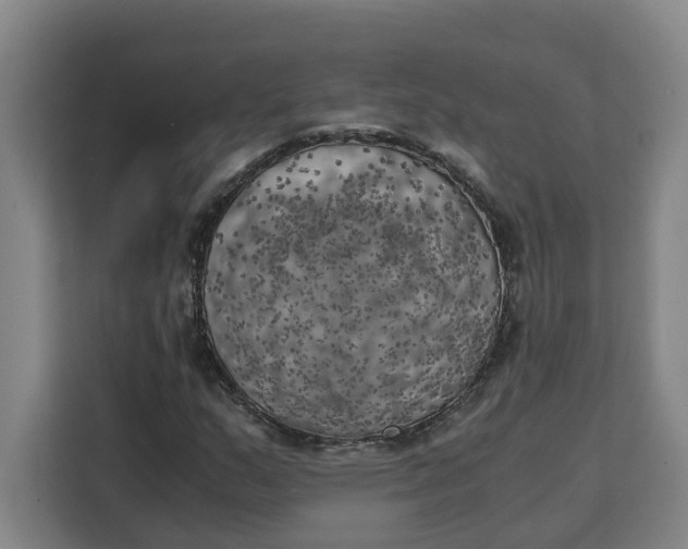 X0000111151159200907141336