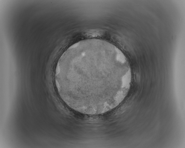 X0000111151393200907141332