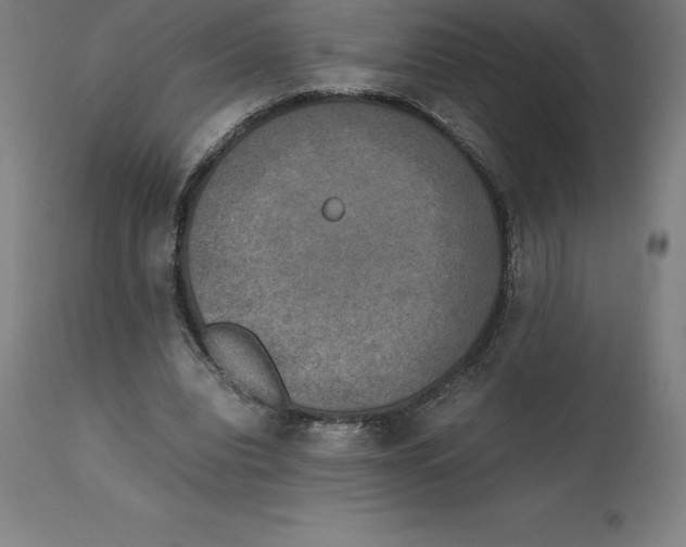 X0000111150440200907211207