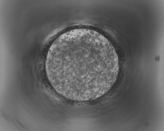 X0000111151159200907211156