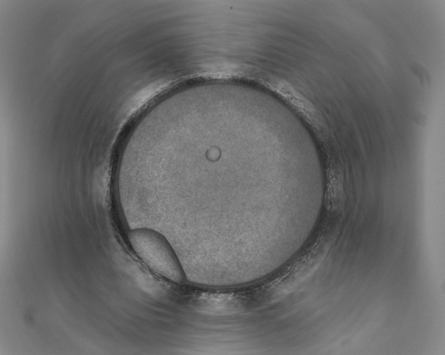 X0000111150440200907281136