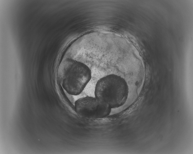 X0000111150145200908111141