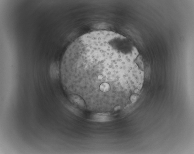 X0000111150179200908111141