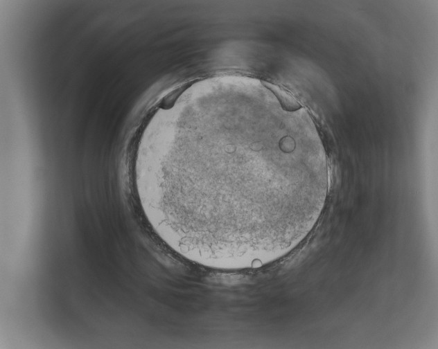 X0000111150339200908111138