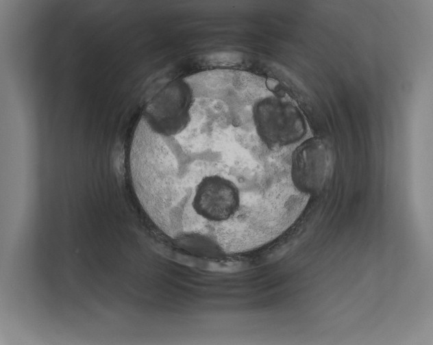 X0000111150745200908111133