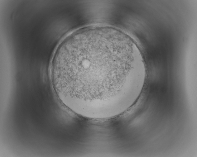 X0000111150856200908111132