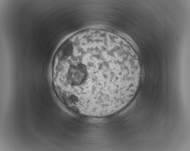 X0000111151036200908111130