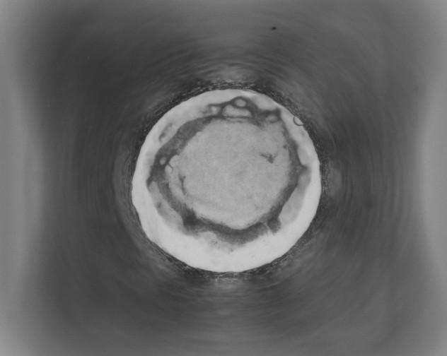 X0000111151297200908111126