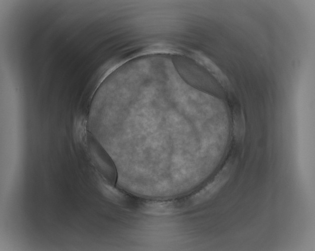 X0000111151369200908111125