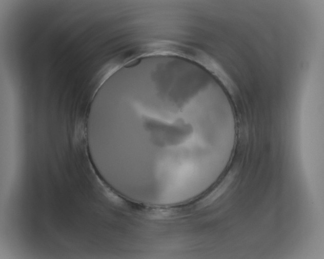 X0000111151385200908111125